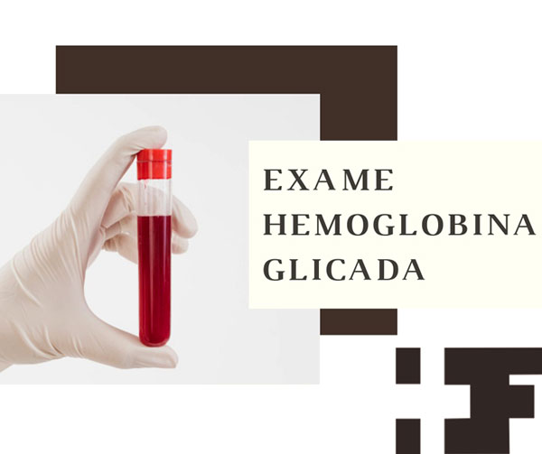 Divulgação - Diferente do exame de glicemia comum, o exame de hemoglobina glicada não necessita de jejum