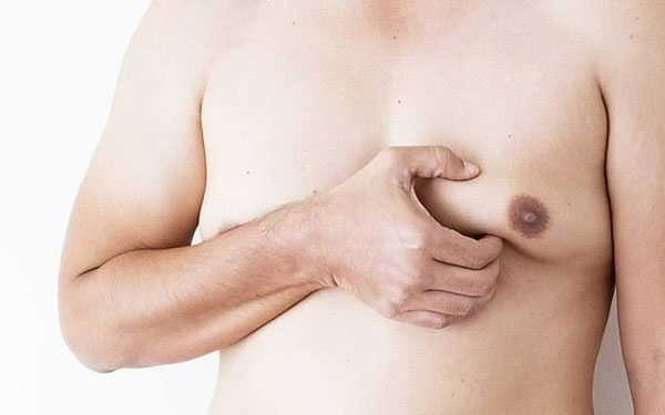 Ilustrativa - Apesar de raro, estimativas indicam que 1% dos casos de câncer de mama afeta homens