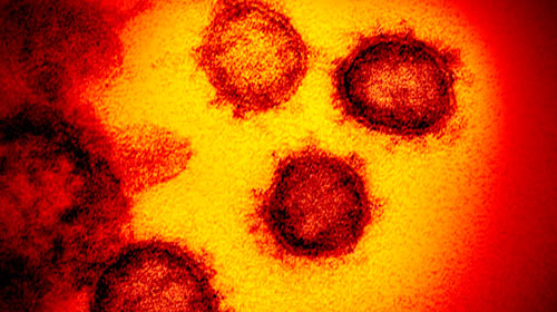 Foto: NIAID-RML/AP - Imagem de microscópico mostra o novo coronavírus