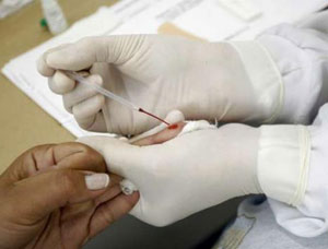 Mutirão de testes de HIV terá plantão neste fim de semana no município