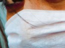 Três suspeitos de H1N1 estão internados em Assis
