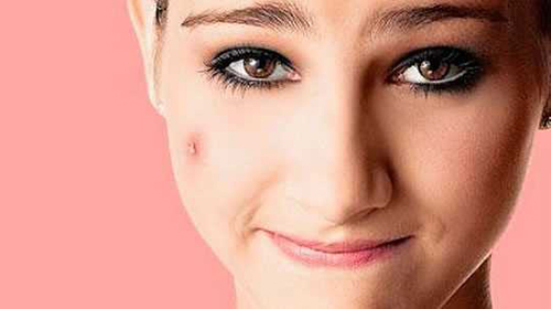 Peles oleosas tendem a sofrer com aparecimento de acne no frio