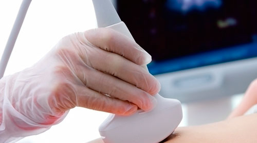 Dia Nacional da Mamografia: Afinal, o exame deve ser realizado aos 40 ou 50 anos?